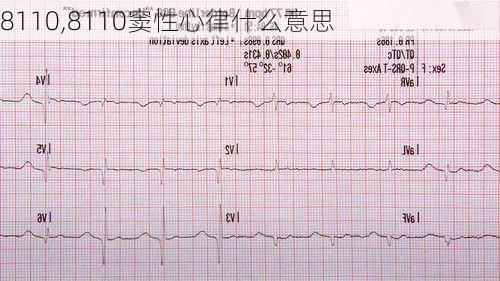 8110,8110窦性心律什么意思