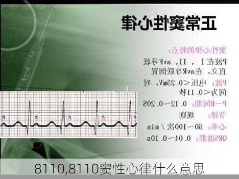 8110,8110窦性心律什么意思