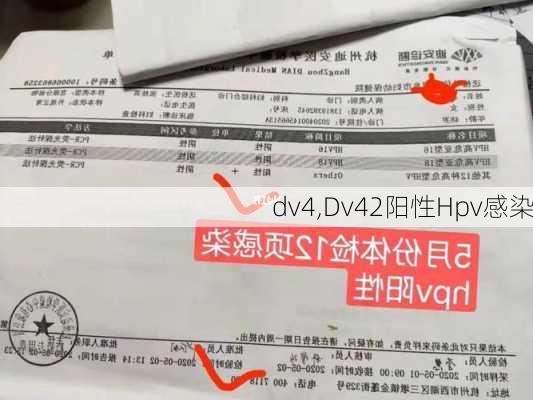 dv4,Dv42阳性Hpv感染